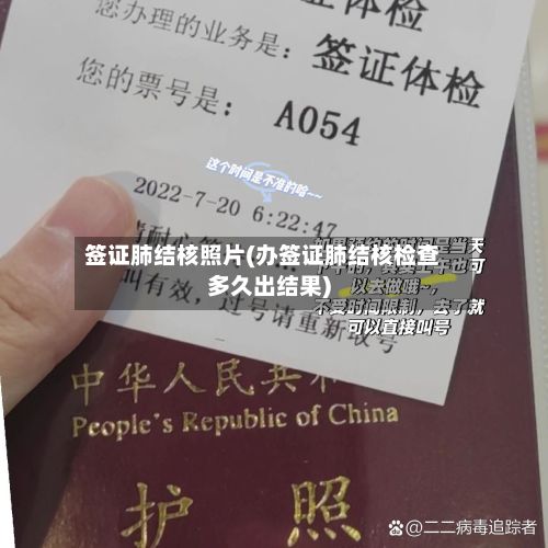 签证肺结核照片(办签证肺结核检查多久出结果)-第2张图片